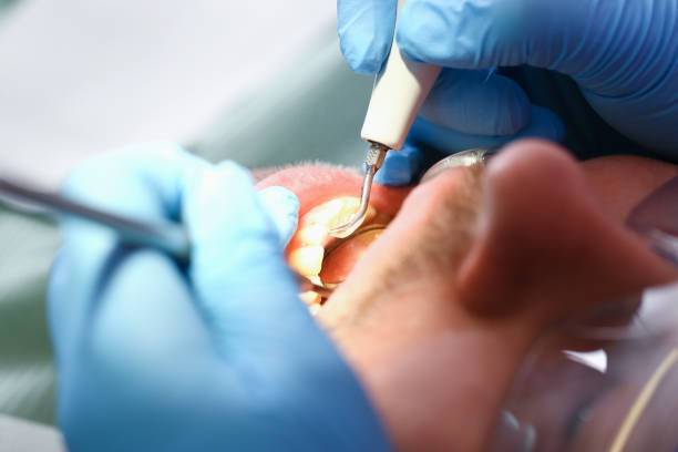 Best Same-Day Emergency Dentist in Grass Lake, MI