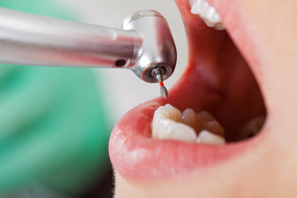 Best Emergency Dental Surgery in Grass Lake, MI
